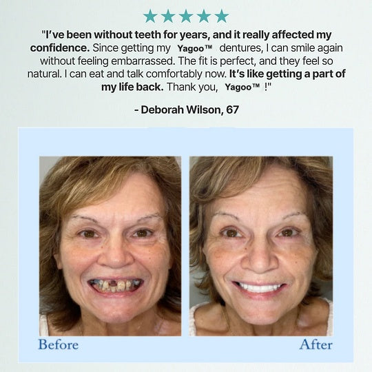 Dentures for 3 Years❓❓❓ Relax—Full Refund If They Fail✅Paypal and Credit Card Payment Guarantee