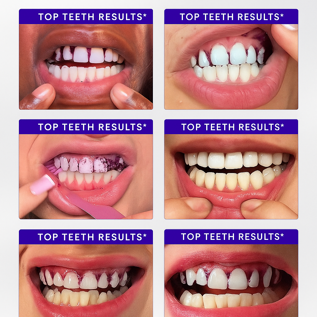😺Whiter teeth in just 30s?! 🔥Last day 50% off - V34 Whitening Strips