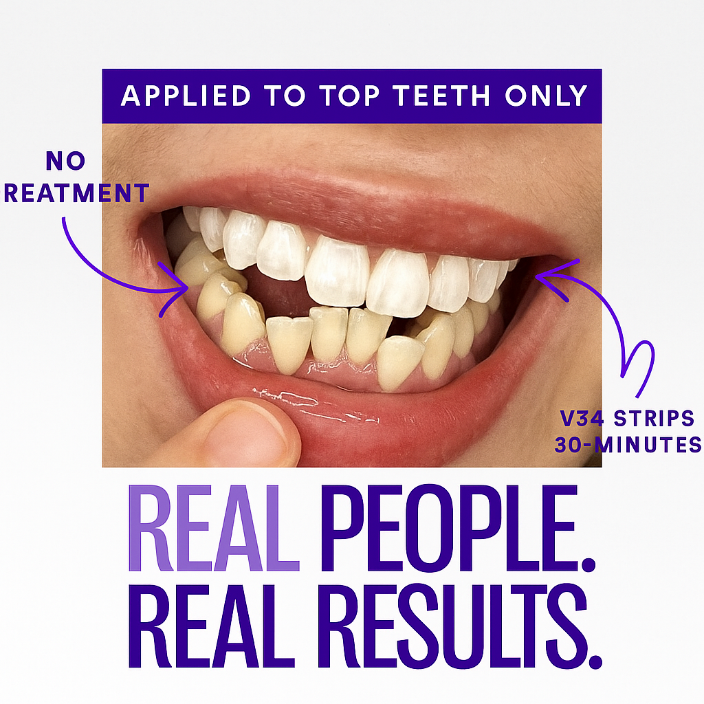 😺Whiter teeth in just 30s?! 🔥Last day 50% off - V34 Whitening Strips