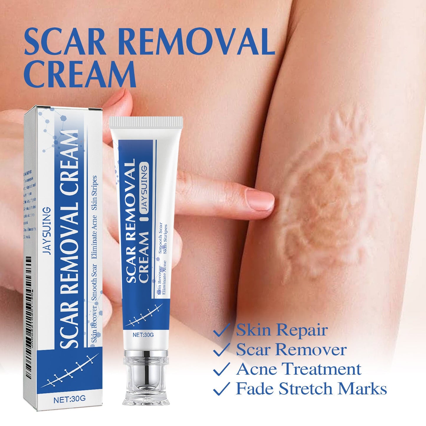 4-Day Scar Removal + 100% Refund If Not Working 🔥 50% off repair cream to smooth out blemishes!🔥