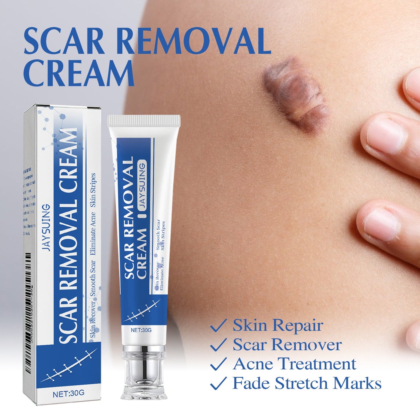 4-Day Scar Removal + 100% Refund If Not Working 🔥 50% off repair cream to smooth out blemishes!🔥