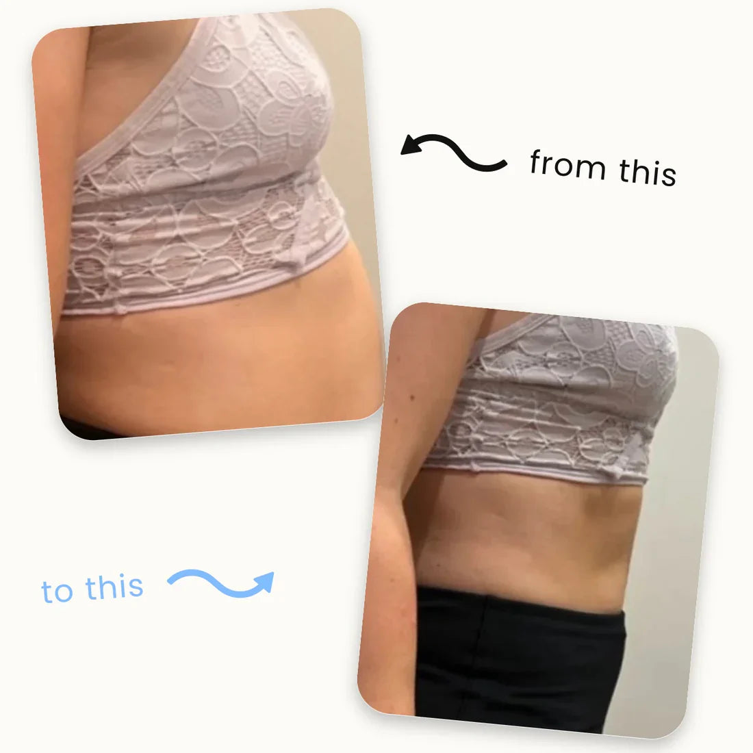 🌿🔥 Lose Weight Naturally – Thousands Sold ✅ Limited Offer 💥Wellness Patches