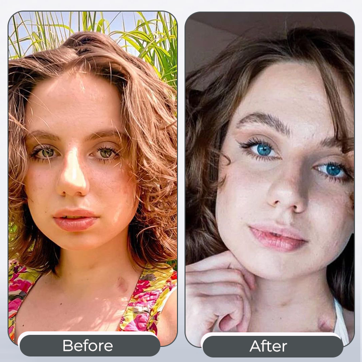 SYRGON⢠Color-Changing Eye Drops đŚâ Transform Your Eye Color Naturally in Just 2 Hours