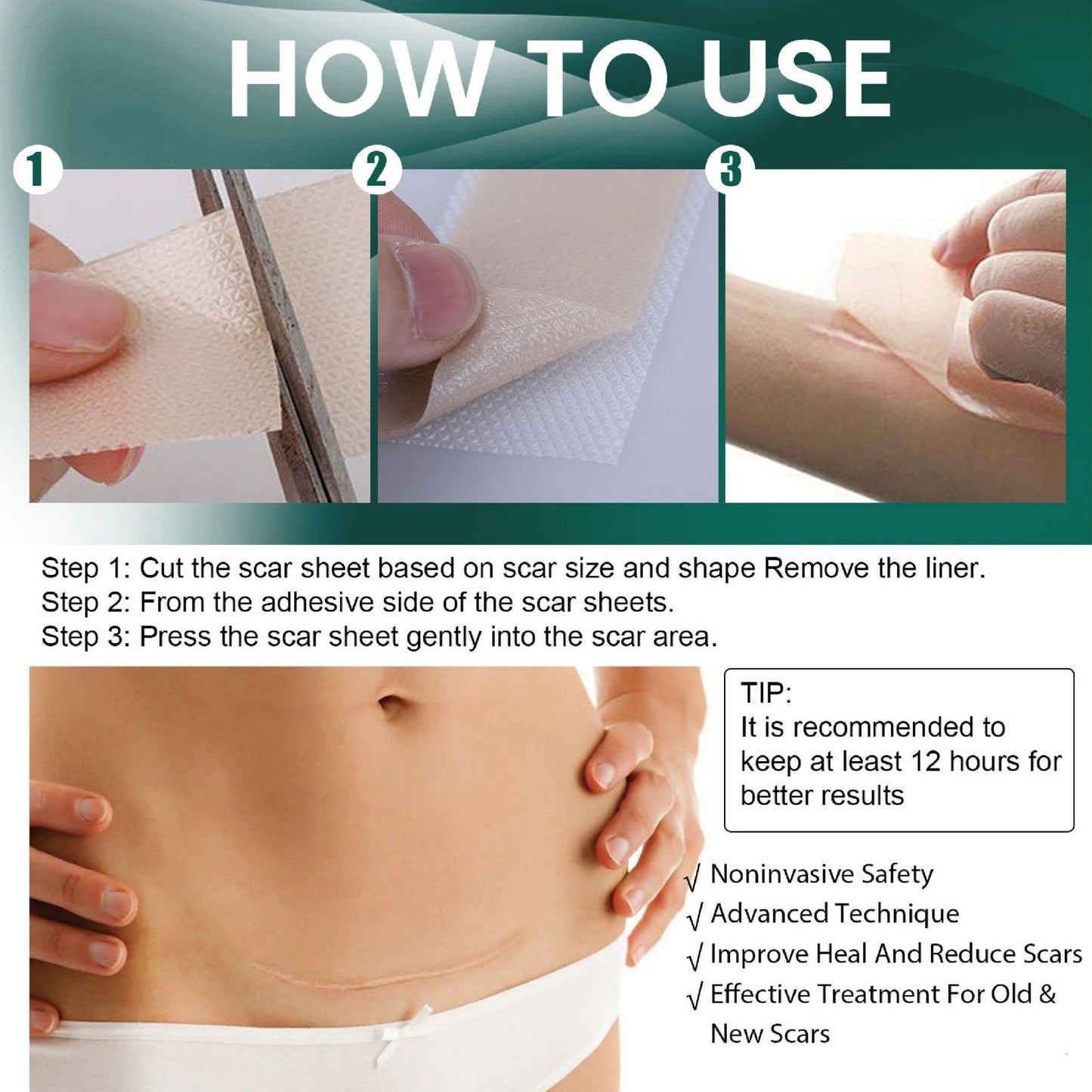 SYRGON™️-Professional Silicone Scar Sheets king- Scars Removal Treatment-Anti-Aging