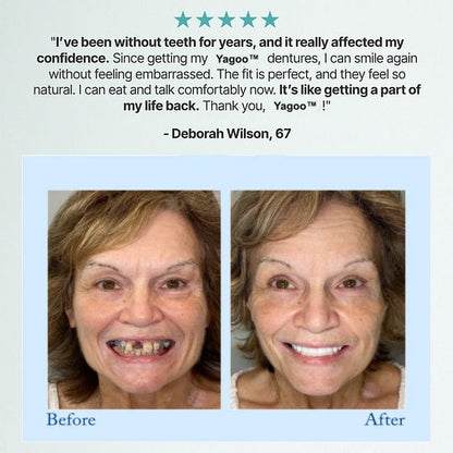 Dentures for 3 Years❓❓❓ Relax—Full Refund If They Fail✅Paypal and Credit Card Payment Guarantee