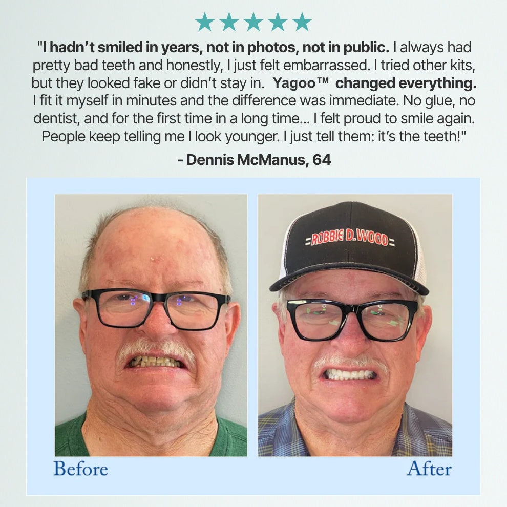 Dentures for 3 Years❓❓❓ Relax—Full Refund If They Fail✅Paypal and Credit Card Payment Guarantee