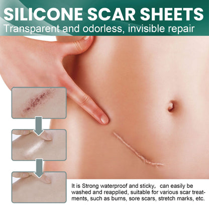 SYRGON™️-Professional Silicone Scar Sheets king- Scars Removal Treatment-Anti-Aging