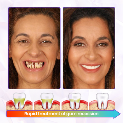 🔥NOW 50%OFF 🔥BeeRenew Advanced Gum Healing Toothpaste