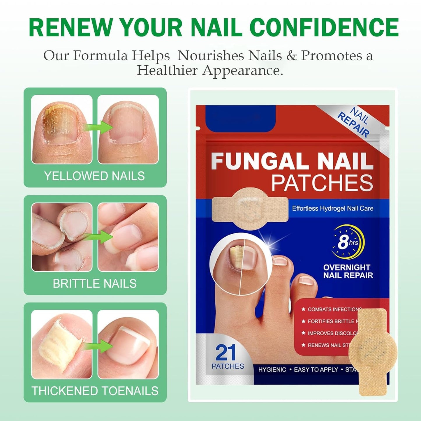 🔥Special offer package-Fungal Nail Patches & Ginger 7 Days Nail Treatment