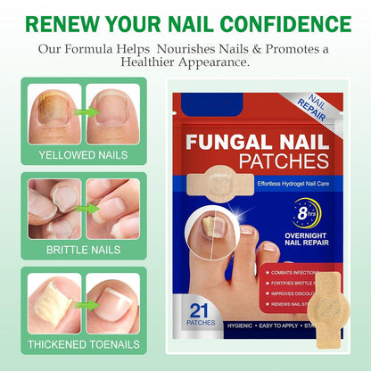 🔥Special offer package-Fungal Nail Patches & Ginger 7 Days Nail Treatment