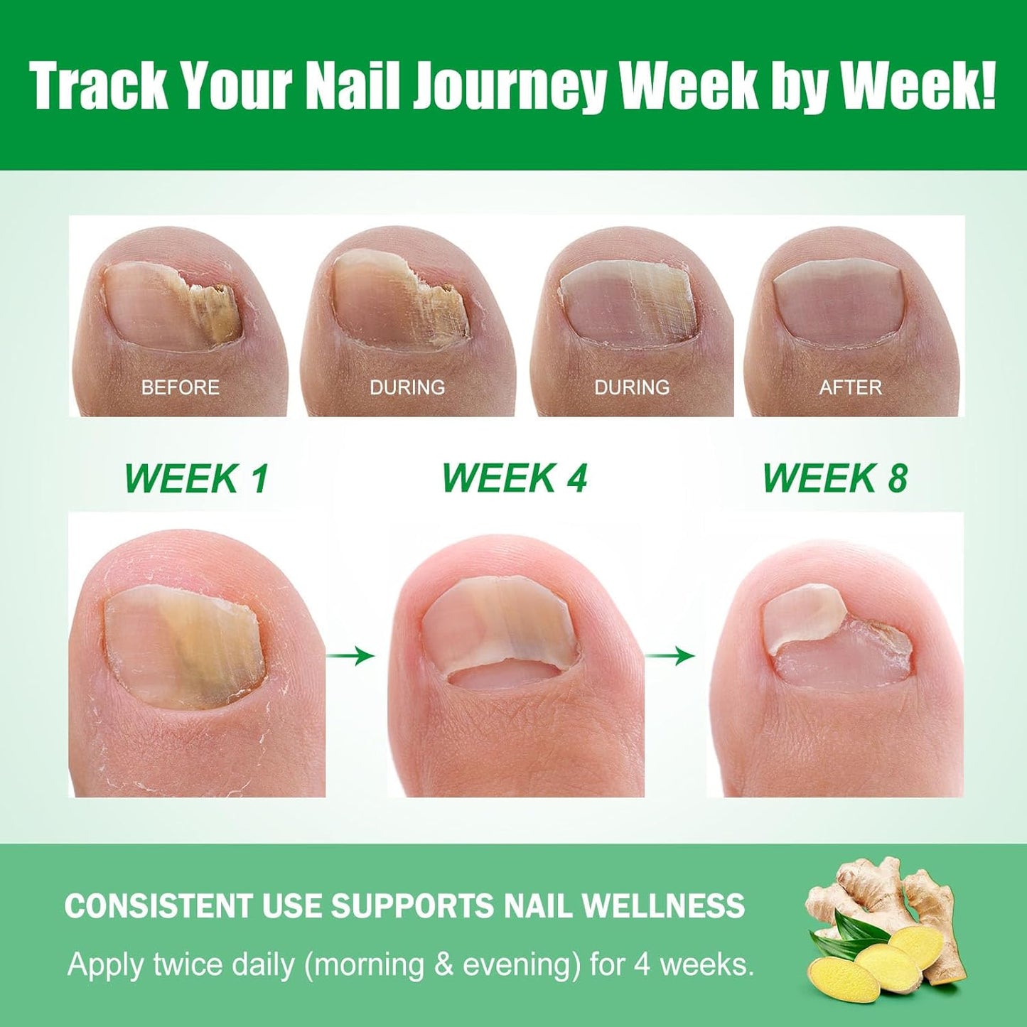 🔥Special offer package-Fungal Nail Patches & Ginger 7 Days Nail Treatment