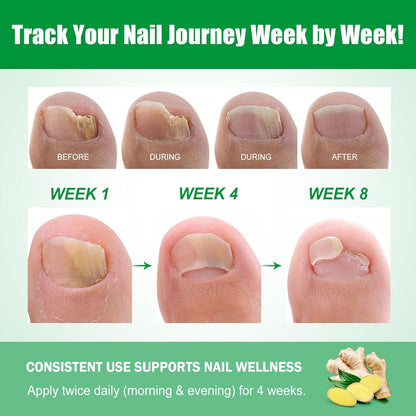 🔥Special offer package-Fungal Nail Patches & Ginger 7 Days Nail Treatment