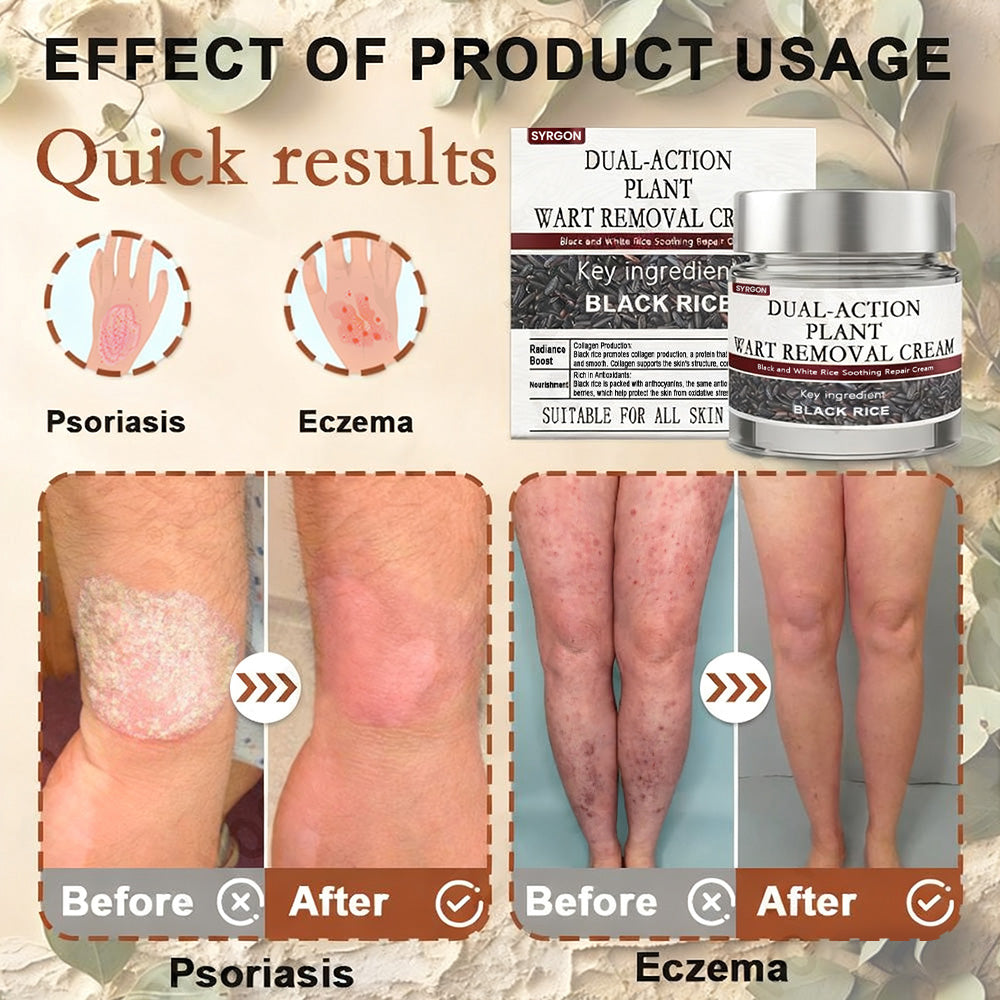 ✅ Visible results in just 5 days-ready to clear warts, skin tags, and dark spots fast? ✨