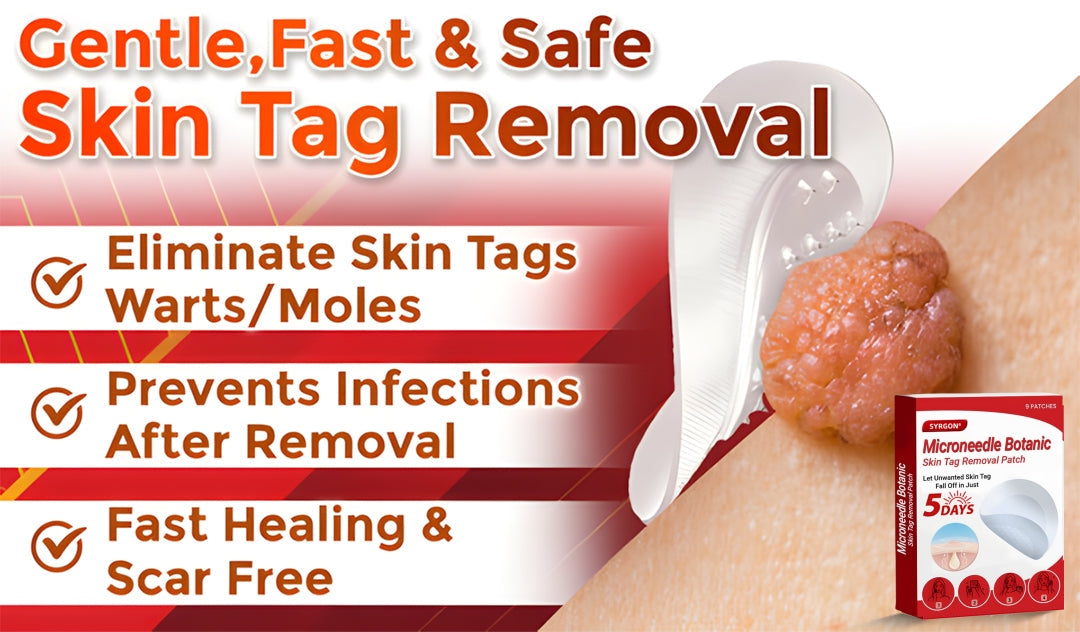 ✅Official Store | SYRGON™ MicroNeedle Skin Tag Remover Patch – Made in the USA
