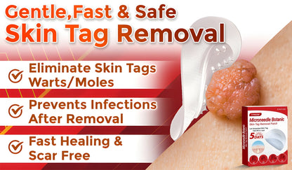 ✅Official Store | SYRGON™ MicroNeedle Skin Tag Remover Patch – Made in the USA