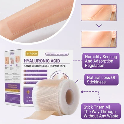 ✅Official Store | Now 50% OFF 🔥SYRGON® Clear Repair Tape