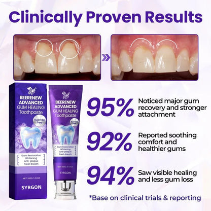 🔥NOW 50%OFF 🔥BeeRenew Advanced Gum Healing Toothpaste