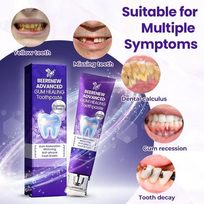 🔥NOW 50%OFF 🔥BeeRenew Advanced Gum Healing Toothpaste