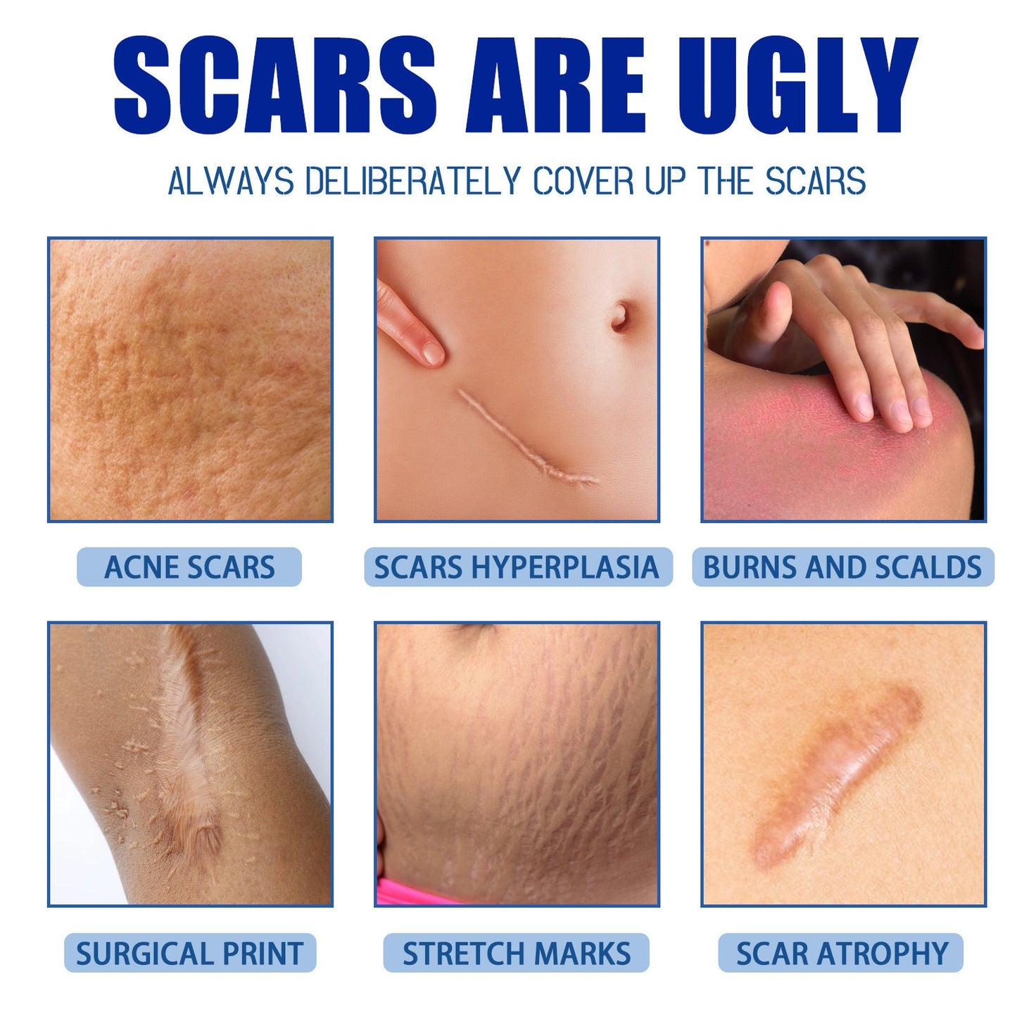 4-Day Scar Removal + 100% Refund If Not Working 🔥 50% off repair cream to smooth out blemishes!🔥