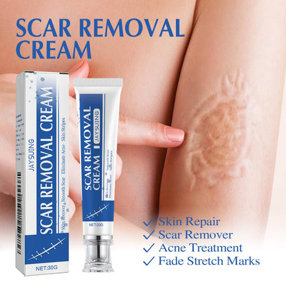 4-Day Scar Removal + 100% Refund If Not Working 🔥 50% off repair cream to smooth out blemishes!🔥