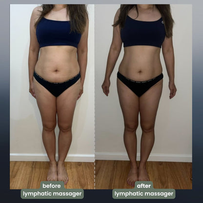 4-in-1 Massager💆‍♂️🔥 Remove Stretch Marks & Detox – Thousands Happy ✅