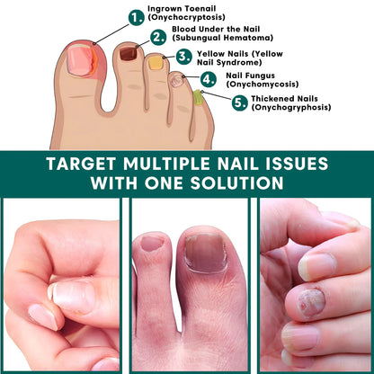 Limited time promotion⏰-Nail Care Pen